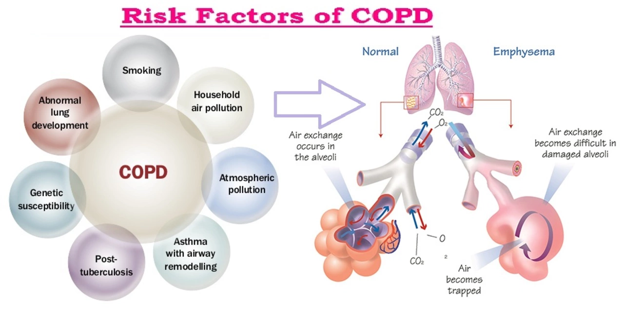 The Different Stages of Chronic Obstructive Pulmonary Disorder: What to Expect