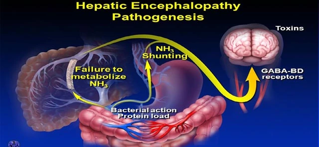 The Impact of Hepatic Encephalopathy on the Central Nervous System